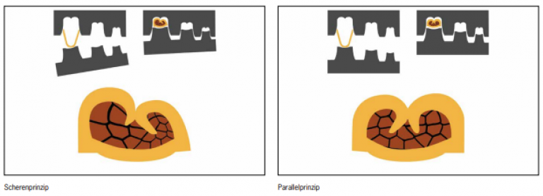 Darstellung des Scherenprinzips und Parallelprinzips beim Crimpen